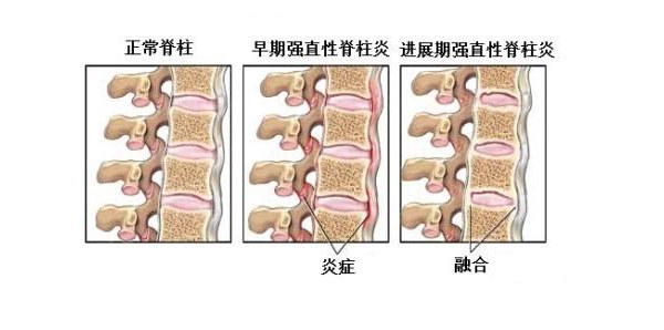 成都强直医院